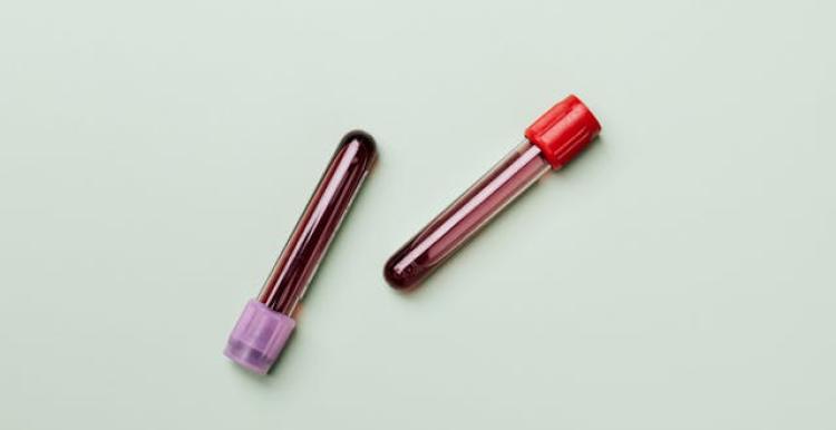 Two vacuette tubes full of blood on a plain background.