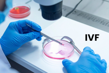 IVF procedure image