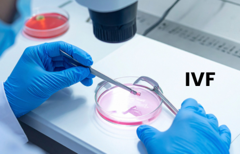 IVF procedure image